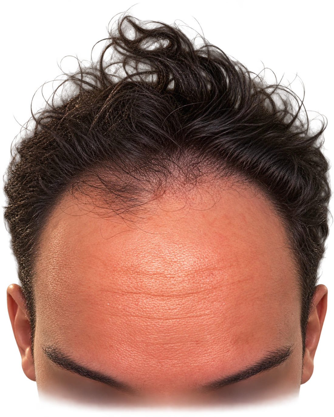 A digital forehead, with eyes obscured for privacy, ready for its next advertiser
